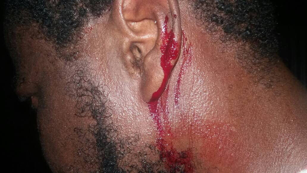 Gabon: le directeur de cabinet d’Ali Bongo fait agresser un jeune qui conteste ses origines