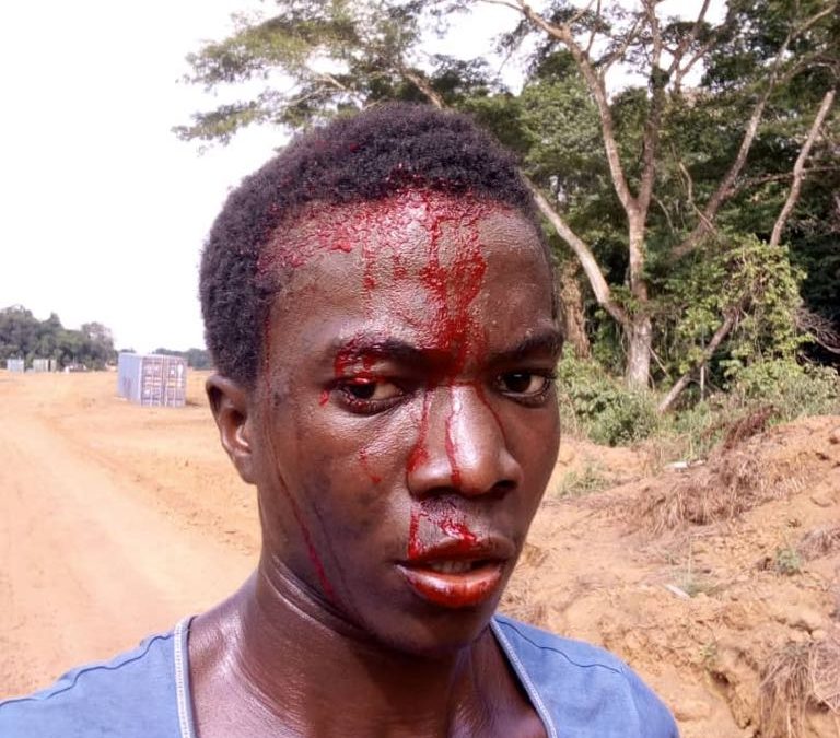 Des Chinois battent à sang des jeunes près de Mandji