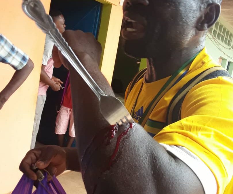 Gabon : un homme sauvagement agressé à la fourchette à Mouila